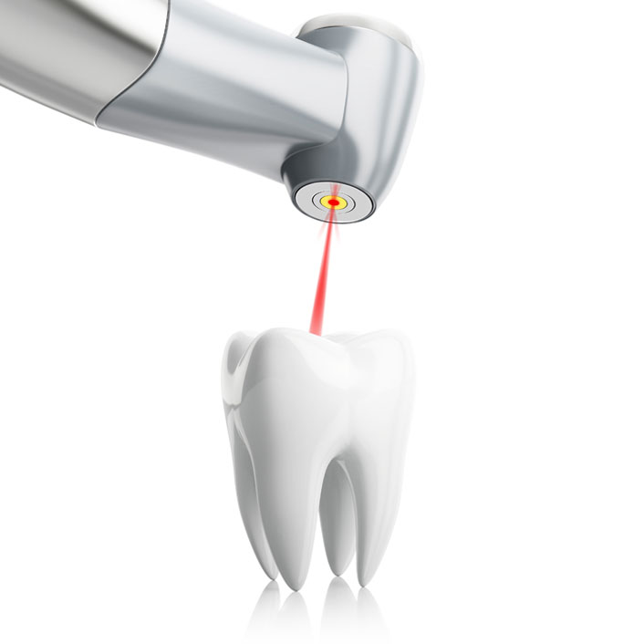 Laser Dentistry - Dental Technologies